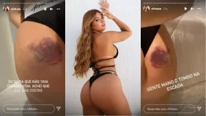 Viih Tube machuca bumbum em queda de escada: ‘Dói muito’